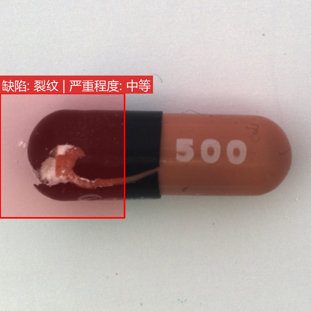 缺陷热区